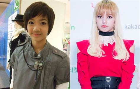 Lisa Blackpink Plastic Surgery