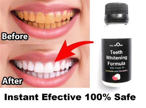 Buy Instant Teeth Whitening Powder To White Your Teeth And Loking