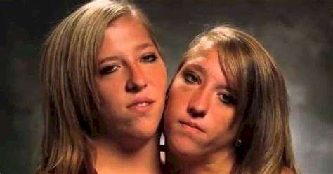 20 Interesting Things About Famous Conjoined Twins Abby And Brittany