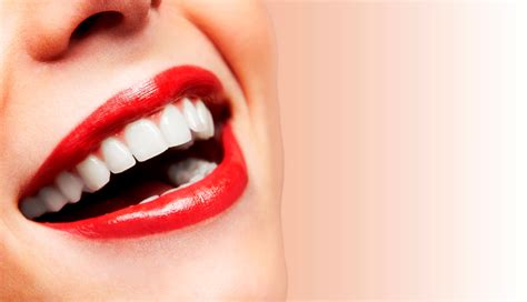 Blanqueamiento Dental Clinica Nudent Trujillo Ortodoncia Implantes