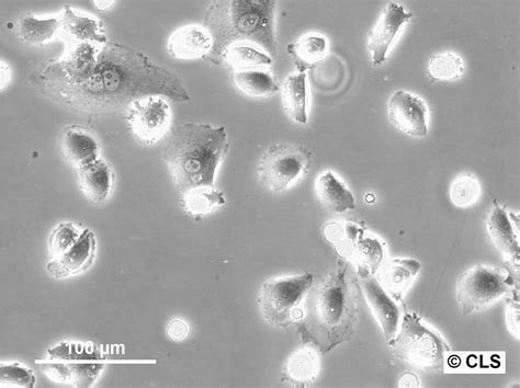 Bacterial Contamination Cell Culture