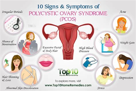 Common Signs And Symptoms Of Polycystic Ovary Syndrome Pcos You