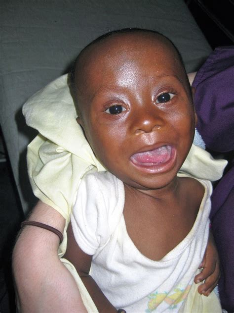 Maybe you would like to learn more about one of these? Serving at Pioneer Christian Hospital in the Congo: Life ...