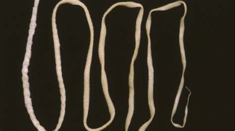 I Have A Pathological Fear Of Tapeworms