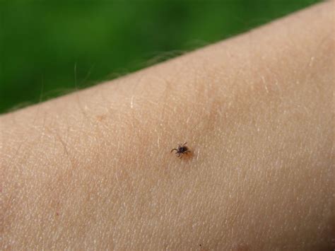 Tick Infestation Does Harm To Humans And Their Domestic Animals