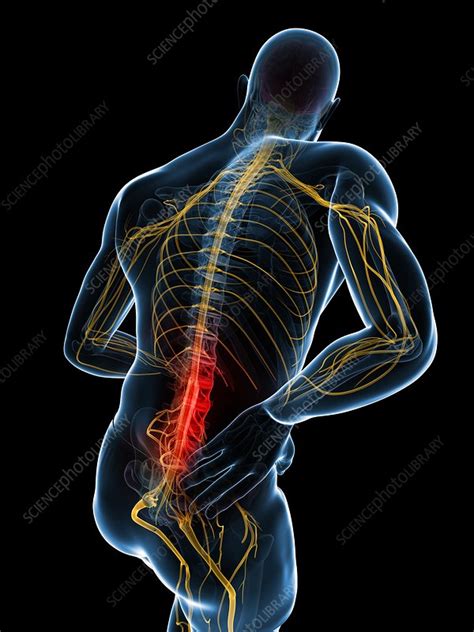 Back Pain Artwork Stock Image F0076703 Science Photo Library