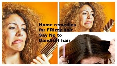 Home Remedies To Control Frizzy Hair Iidandruff Control Ii Easy Way Youtube