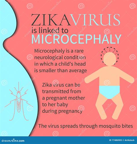 Zika Virus Microcephaly Poster Stock Vector Illustration Of Element