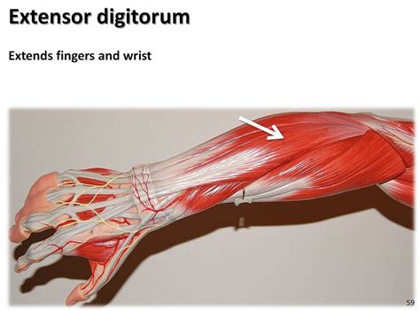 Lesson on the anatomy of the forearm: Extensor digitorum - Muscles of the Upper Extremity Visual ...