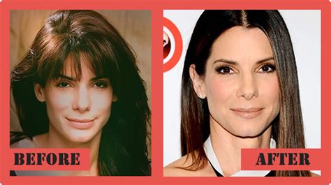 17 Celebs Who Have Had A Cosmetic Surgery Wonder Wardrobes