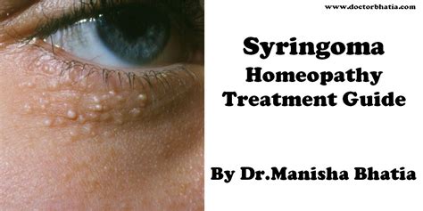 Syringoma Homeopathy Treatment And Homeopathic Remedies Doctor Bhatia