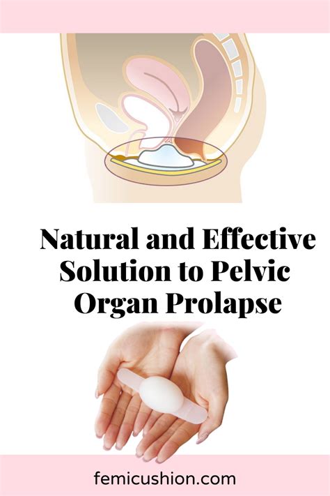 Effective Solution To Pelvic Organ Prolapse Alternative To Surgery And