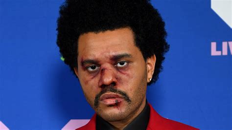 Did The Weeknd Have Plastic Surgery His New Look Explained