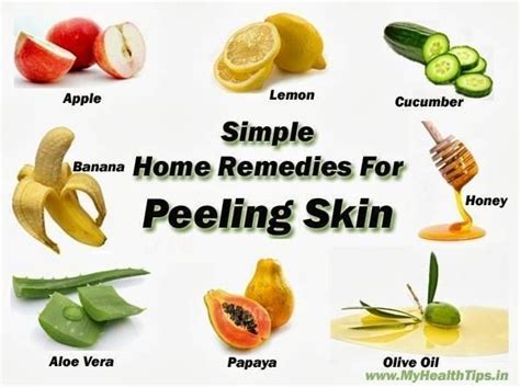 Home Remedies For Peeling Skin Peeling Skin Home Remedies Remedies