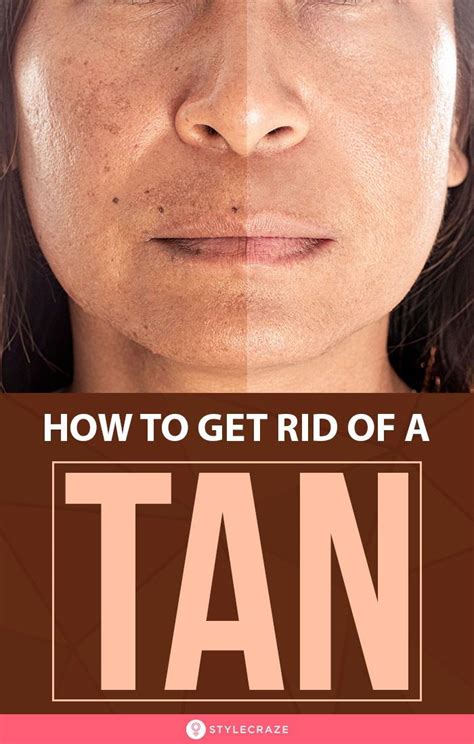 How To Remove Tan From The Face And Skin Naturally In Tan