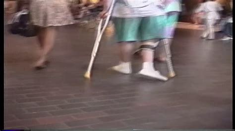 Crutchman Polio Expo Polio Leg Braces Crippled Woman Crutching