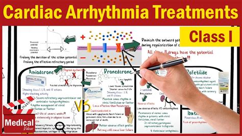 Pharmacology Cvs 14 Cardiac Arrhythmia Treatments Class 1
