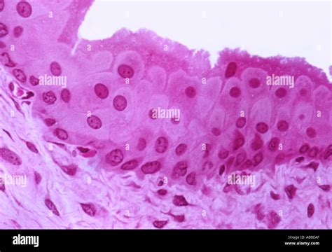 Transitional Epithelium Hi Res Stock Photography And Images Alamy