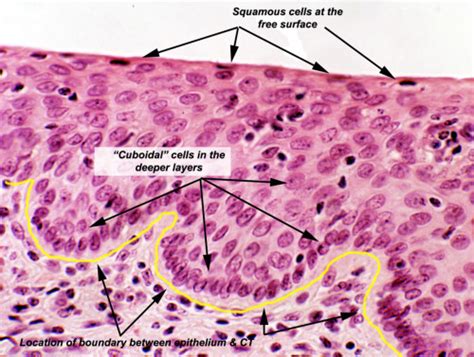 Stratified Squamous Epithelium Dead Outermost Cells And Living Inner