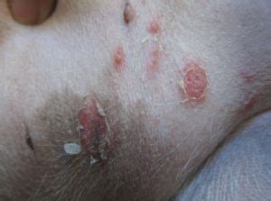Learn how this common problem is impetigo may affect skin anywhere on the body, but is most common around the nose and mouth, hands, and forearms, and in young children, the diaper. Dog Skin Allergy | Dog Health Services | Pet Care Hospital