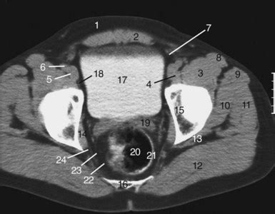 There are many organs that sit in the pelvis, including much of the urinary system, and lots of the male or female reproductive systems. The pelvis | Radiology Key