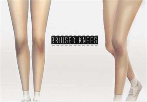 Onelama Bruised Knees Sims 4 Downloads Sims 4 Sims Sims 4 Cc