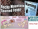 Rocky mountain spotted fever