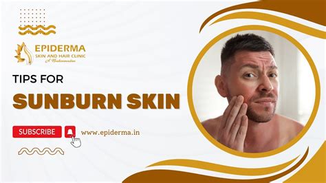 Podcast Tips For Sunburn Skin Best Skin Clinic In Jayanagar