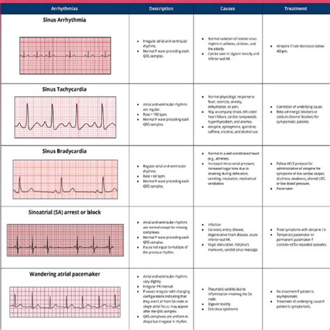 Basic EKG Interpretation 3 Pages Long Printable Pdf Immediate