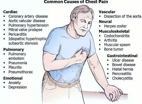 Common Causes Of Chest Pain Medicine And Surgery Pinterest