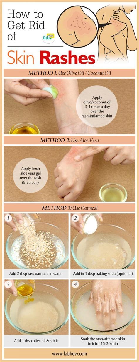 Home Remedies For Rashes Fab How