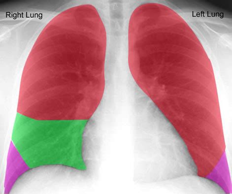 See more ideas about anatomy art, lungs art, lungs drawing. Review: Lobes of Lungs Anteriorly, CT Scan Overview: Chest -- Health Center, University of ...