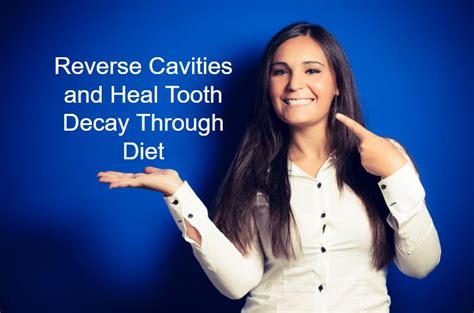 Read all about cavity symptoms, rotten teeth causes, how to fortunately, if caught early, it can be easy to reverse tooth decay and prevent a cavity from we'll also go over how tooth decay leads to cavities and rotten teeth and ways to stop the infection. How to Reverse Cavities and Heal Tooth Decay Through Diet ...