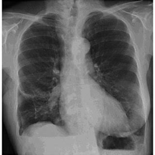 Keywords provided by arschang valipour, ludwludwig boltzmann institute for copd and respiratory epidemiology: ARSCHANG VALIPOUR | MD, FCCP, Assoc. Prof. | Wiener ...