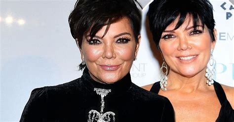 Kris Jenner Surgery From Her Ears To Her Neck Everything The Kuwtk