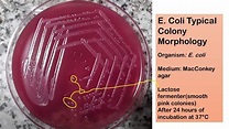 E coli typical colony morphology on Macconkey agar - YouTube