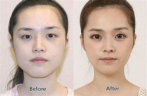 Korean Women Plastic Surgery Funnymadworld