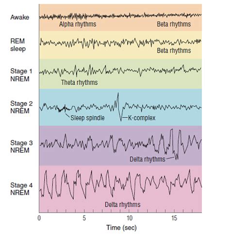 Electroencephalogram Eeg Techniques Measuring Sleep Activity And