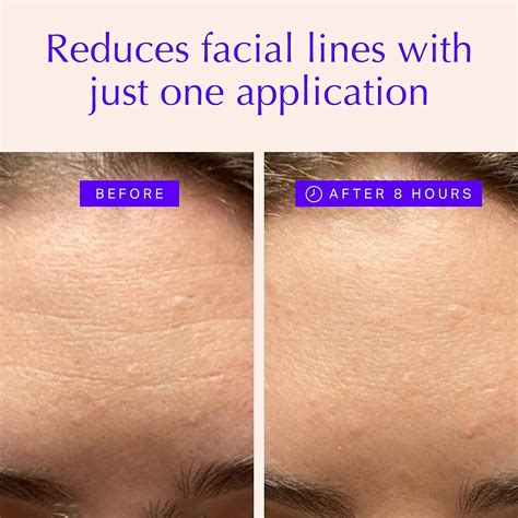 Face And Forehead Wrinkle Patches Anti Wrinkle Patches To Smooth Eye