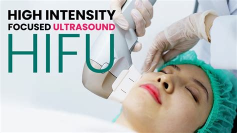 High Intensity Focused Ultrasound Hifu Everything You Wanted To Know Youtube