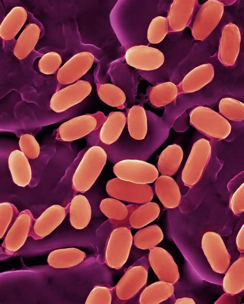 Bacillus Stearothermophilus Photograph By Dennis Kunkel Microscopy
