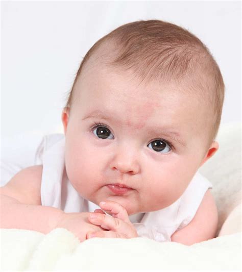 Birthmarks In Babies Causes Types And Treatment Momjunction