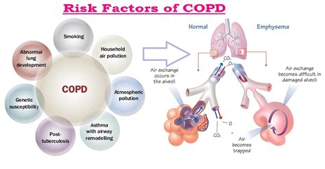 How Does Chronic Obstructive Pulmonary Disease Affect Lung Capacity PELAJARAN