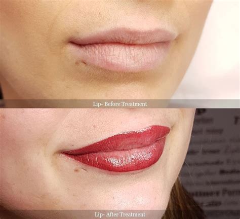 💋 Permanent Makeup Lip Before After By Andrea Toth 💋 Permanent Makeup Lip Makeup Makeup