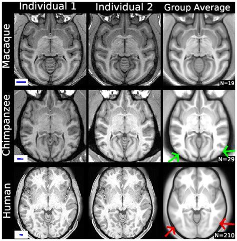 Cerebral Cortical Folding Parcellation And Connectivity In Humans