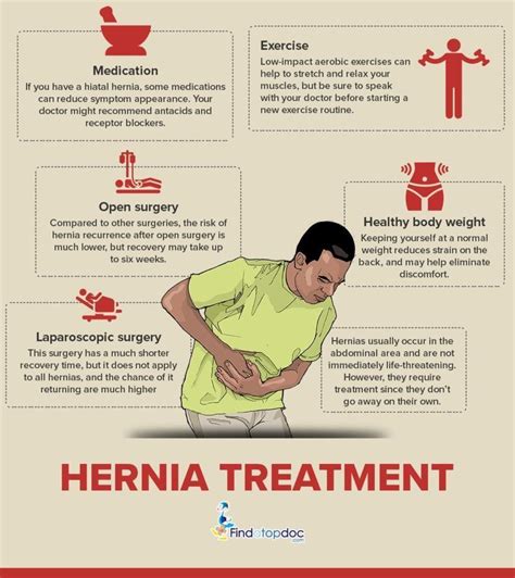 How Exercise Affects The Symptoms Of Hiatal Hernia Lo Vrogue Co