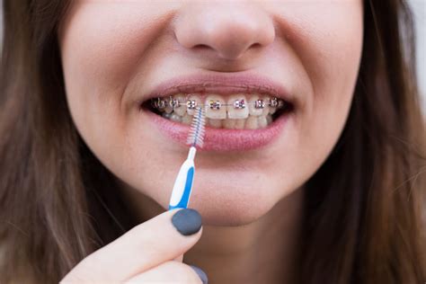 Escova Interdental O que é benefícios e como usar MaisOdonto