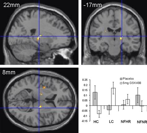 Functional Magnetic Resonance Imaging Fmri Results Day 28