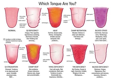 Chinese Medicine Tongue Diagnosis Comox Valley Acupuncture