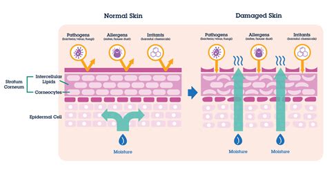 Skin Management Dry And Sensitive Skin Ceradan